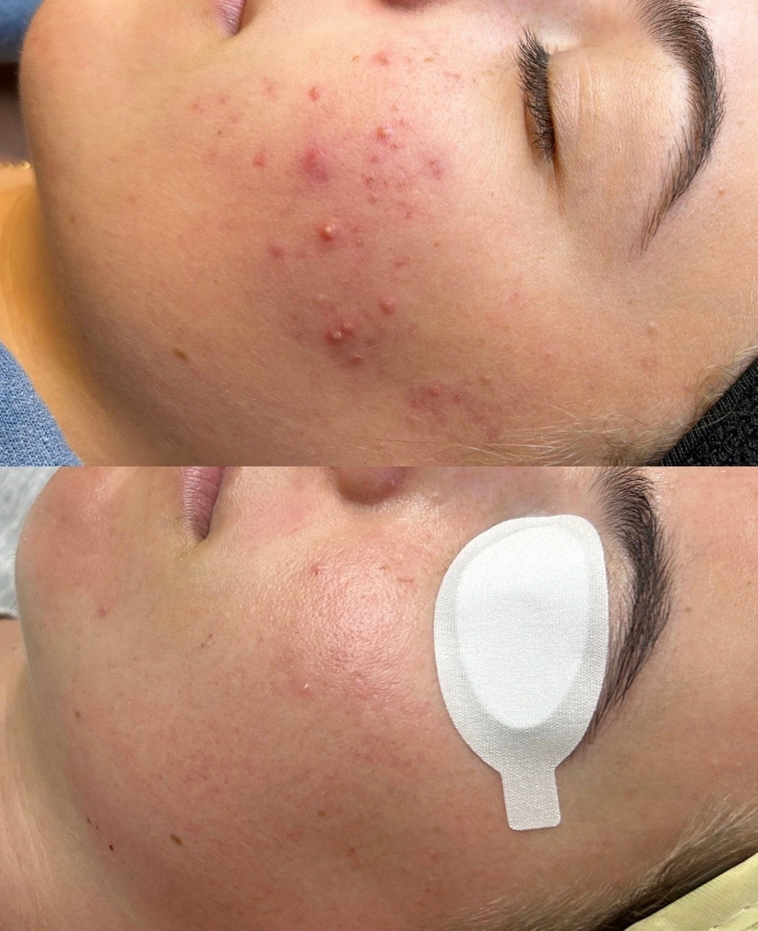 Rosacea Treatment Miami: What Actually Works & Where to Go