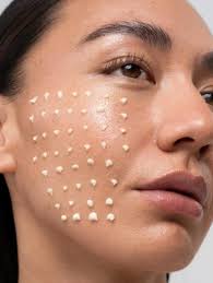Microneedling vs Liquid Microneedling Miami — What's the Difference and Which One Do You Need?