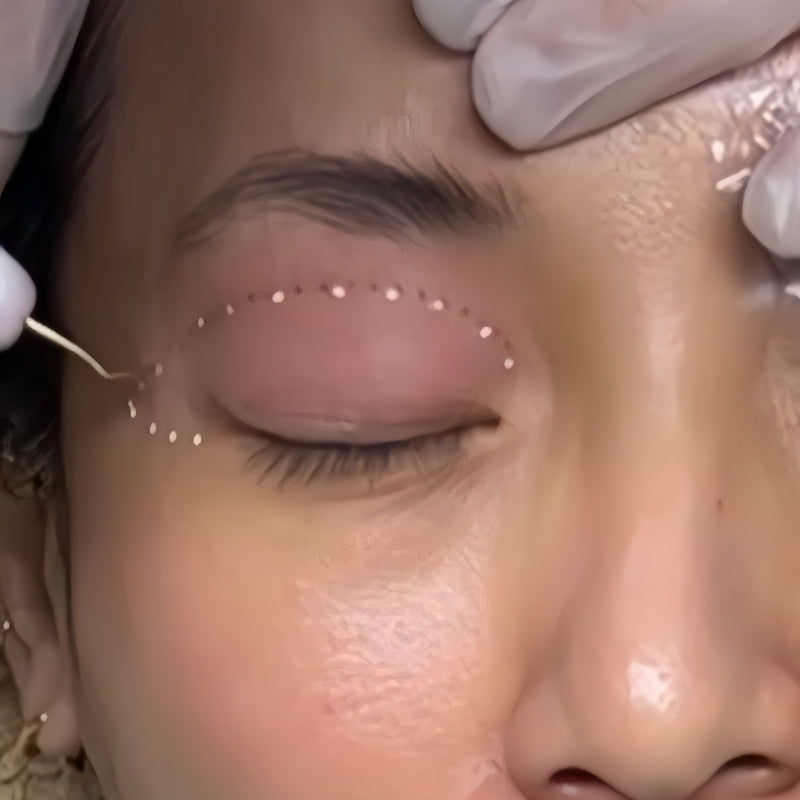 Close-up of a person receiving eyebrow threading treatment.