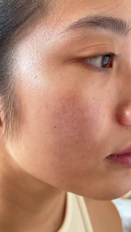 Feel the Heal Kojic Acid Brightening Face Serum | Fades Dark Spots, Hyperpigmentation & Melasma