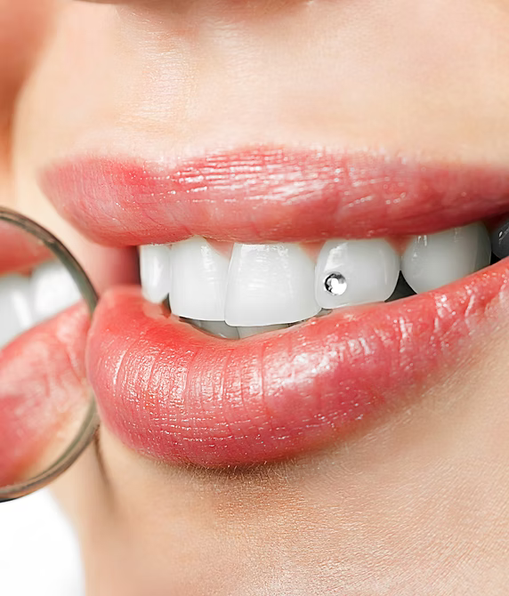 Close-up of a person's mouth with a diamond-studded tooth.